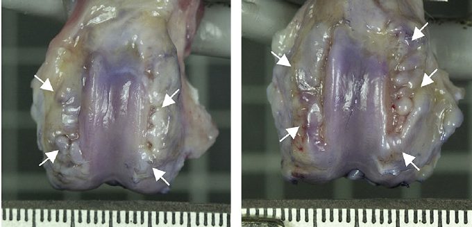 Изображение - Доа левого коленного сустава 3 степени Fig-4-Osteophytes-on-the-distal-femur-Extensive-osteophyte-production-between-arrows