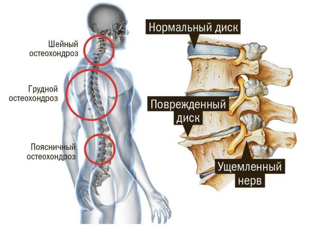 Гимнастика для грудного отдела позвоночника с картинками