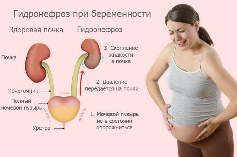 Если при беременности болит спина внизу живота