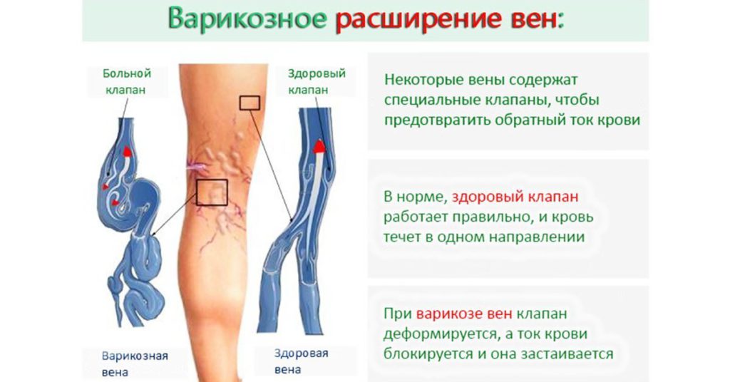 От чего болят стопы ног лечение