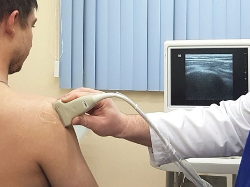 Синовит плечевого сустава народное лечение