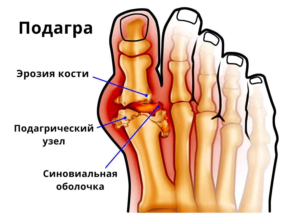 Болят мышцы ступни ног thumbnail
