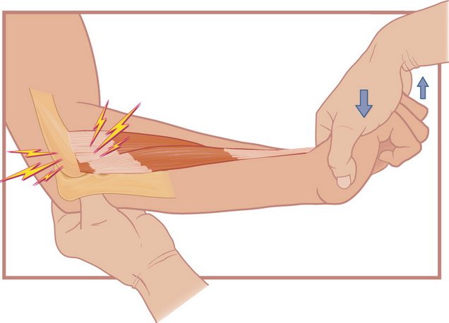 Болезни локтевого суставов рук симптомы лечение