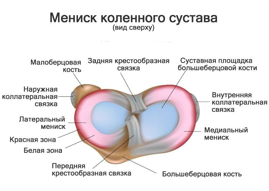 Артроза левого коленного сустава и разрыва заднего рога thumbnail