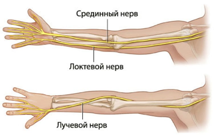 Защемление локтевого нерва в руке симптомы