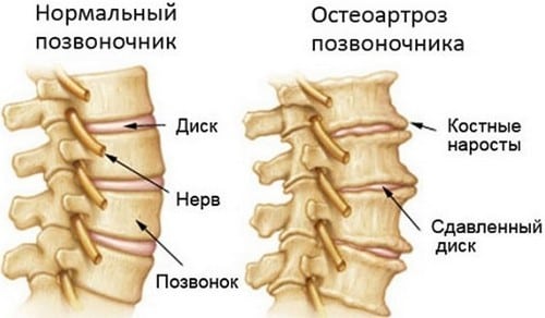 Причины появления боли в шее при повороте головы и методы лечения
