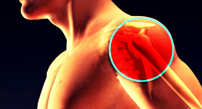 Массаж при хондрозе плечевого сустава