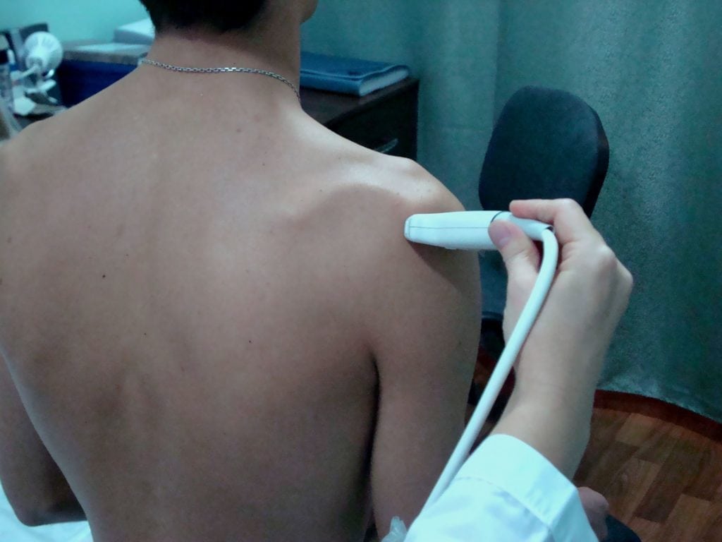 Импинджмент синдром плечевого сустава упражнения видео