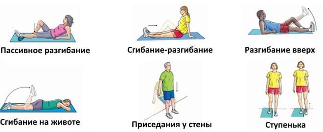 Восстановление колена после растяжения связок