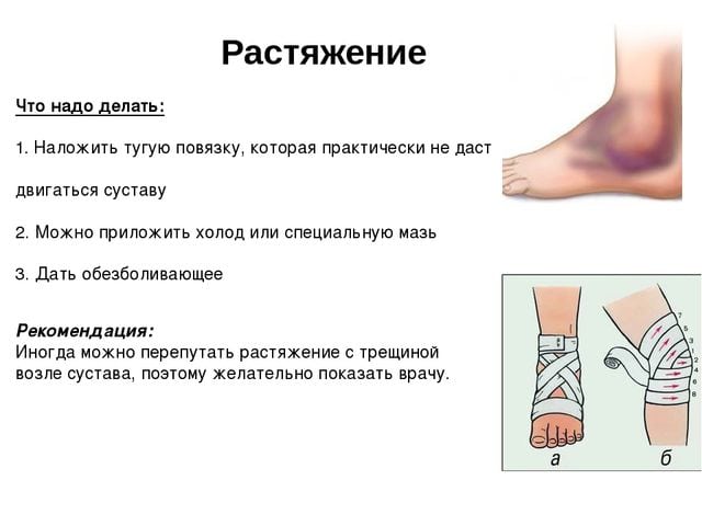Разрыв связок и мышц ноги лечение
