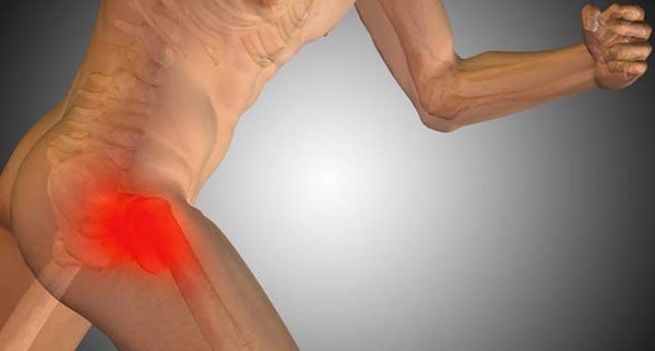 Почему болят мышцы ног выше колен с внутренней и внешней сторон