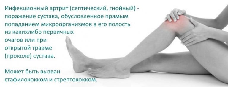 Грибковый артрит коленного сустава