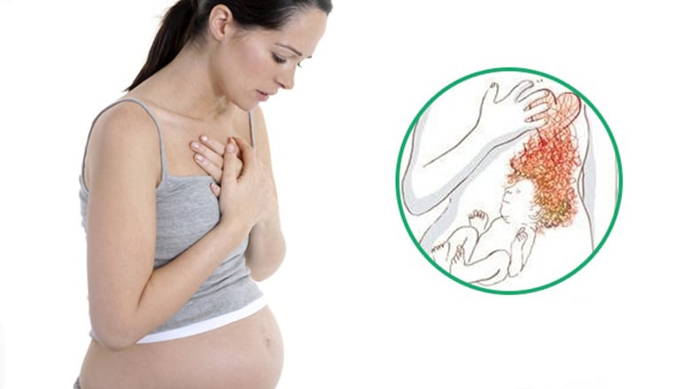 Лечение остеохондроза при беременности