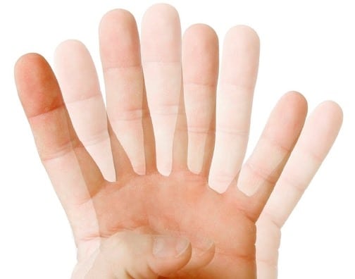 Зрение и остеохондроз лечение глаз thumbnail