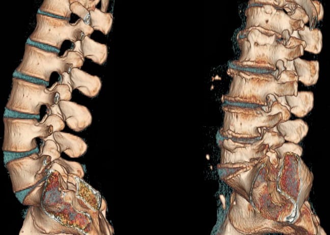Почему болит спина – 7 основных причин — «Бест Клиник»